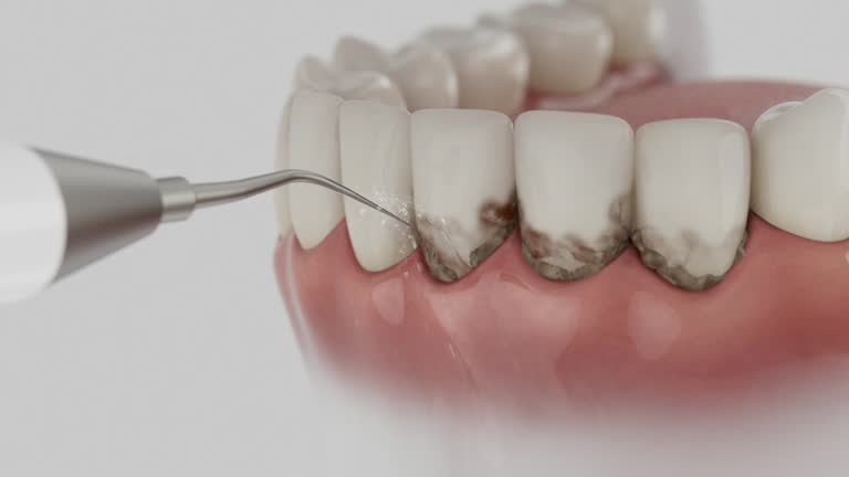 Reliable Dental Implants contractor in Johnstown, OH by Smile Center Dentistry